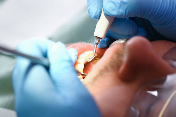Best Pediatric Emergency Dentist in Pen Argyl, PA